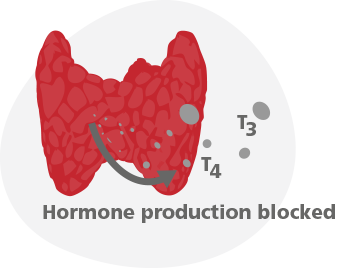 Hyperthyroid blocked production